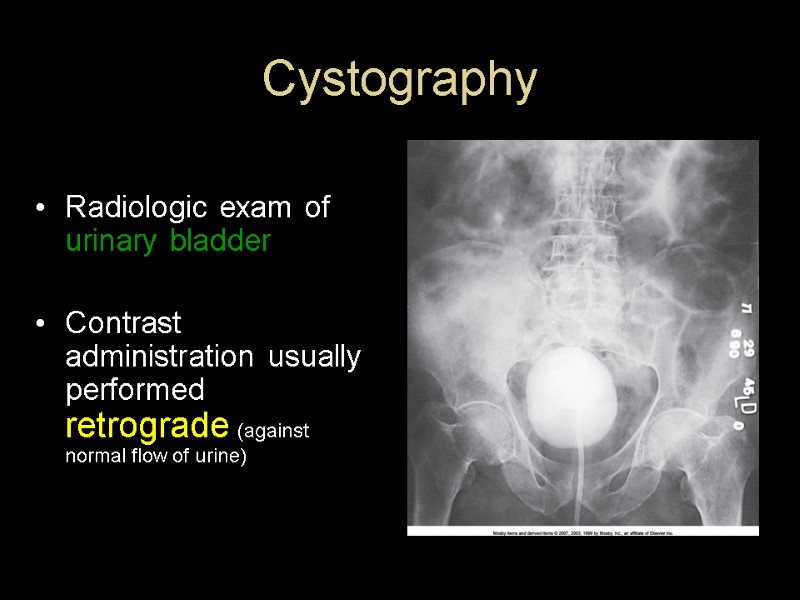 Cystography Radiologic exam of  urinary bladder  Contrast administration usually performed retrograde (against